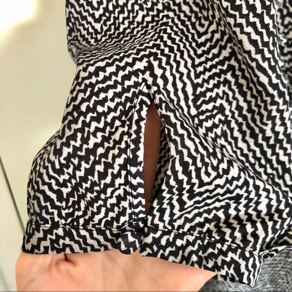 ⭐️ Scotch and Soda black and white patterned dress - Picture 4 of 5